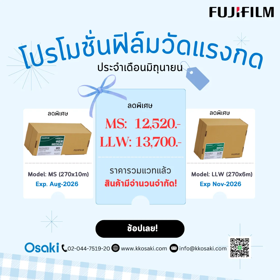 ยังลังเลอยู่หรือเปล่า? ของดีราคาพิเศษ มีจำนวนจำกัด!